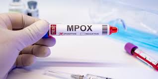 MPOX