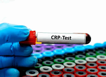 CRP 360x260