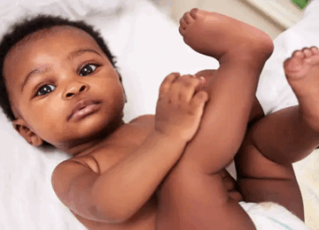 Bebe avec boutons de chaleur sur le dos causes par lhumidite 360x260